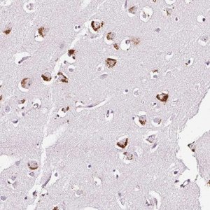 Anti-RTFDC1 antibody produced in rabbit HPA053986-100UL