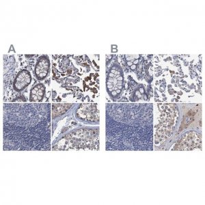 Anti-RTKN2 antibody produced in rabbit 