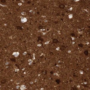 Anti-RTN3 antibody produced in rabbit 