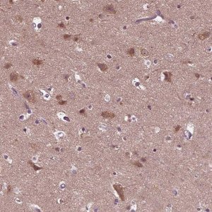 Anti-RUFY3 antibody produced in rabbit 