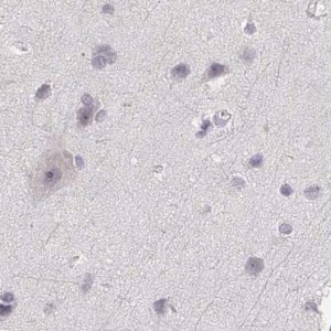 Anti-RUNDC3A antibody produced in rabbit 