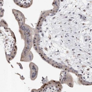 Anti-RWDD2A antibody produced in rabbit 