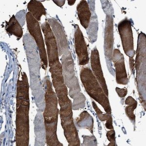 Anti-RWDD2B antibody produced in rabbit 