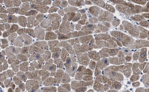 Anti-Ryanodine Receptor 2 Antibody, clone 2K6 ZooMAb Rabbit Monoclonal 