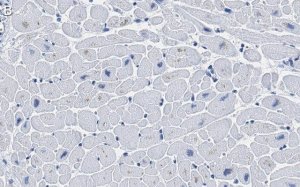 Anti-Ryanodine Receptor 2 Antibody, clone 2K6 ZooMAb Rabbit Monoclonal 