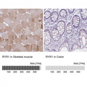 Anti-RYR1 antibody produced in rabbit 