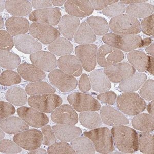 Anti-RYR1 antibody produced in rabbit 