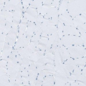 Anti-RYR2 antibody produced in rabbit 