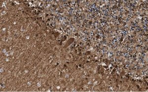 Anti-S100-B Antibody, clone 8F20 ZooMAb Rabbit Monoclonal 