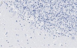 Anti-S100-B Antibody, clone 8F20 ZooMAb Rabbit Monoclonal 