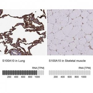 Anti-S100A10 antibody produced in rabbit 