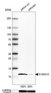 Anti-S100A10 antibody produced in rabbit 