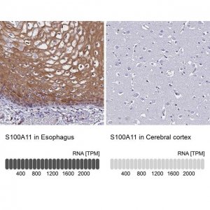 Anti-S100A11 antibody produced in rabbit 