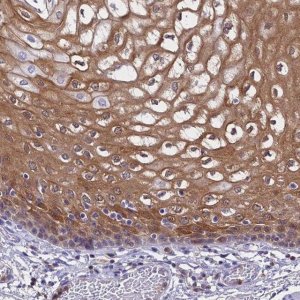 Anti-S100A11 antibody produced in rabbit 