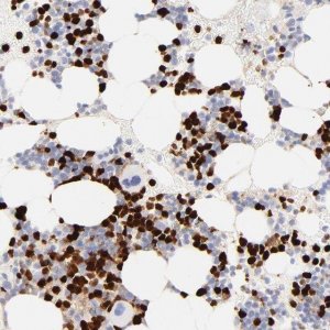 Anti-S100A12 antibody produced in rabbit 