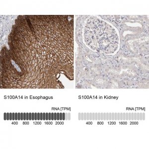 Anti-S100A14 antibody produced in rabbit 