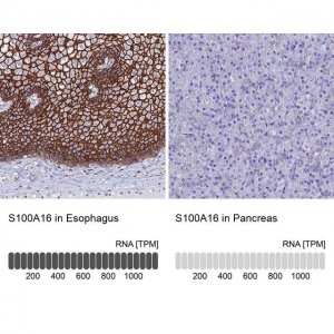 Anti-S100A16 antibody produced in rabbit 