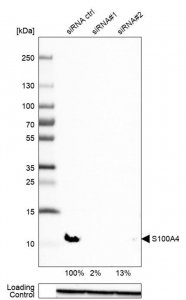 Anti-S100A4 antibody produced in rabbit 