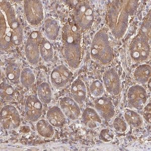 Anti-S100G antibody produced in rabbit 
