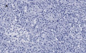 Anti-S6 Ribosomal Protein Antibody, clone 1E9, ZooMAb Rabbit Monoclonal 