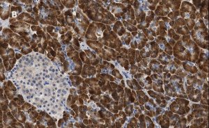 Anti-S6 Ribosomal Protein Antibody, clone 1E9, ZooMAb Rabbit Monoclonal 