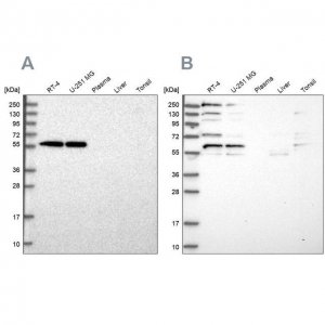 Anti-SAAL1 antibody produced in rabbit 