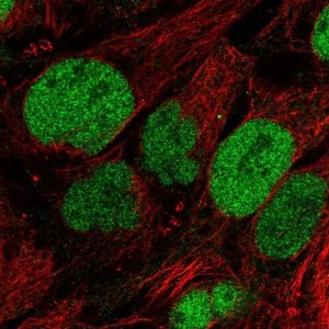 Anti-SAAL1 antibody produced in rabbit 