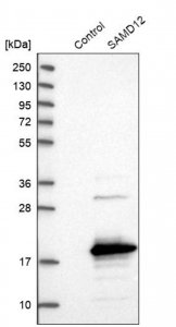 Anti-SAMD12 antibody produced in rabbit 