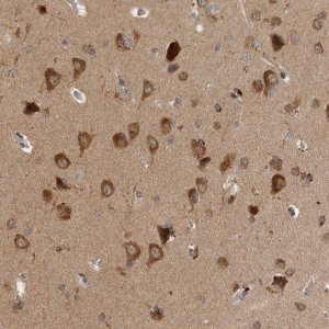 Anti-SAMD12 antibody produced in rabbit 