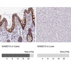 Anti-SAMD13 antibody produced in rabbit 