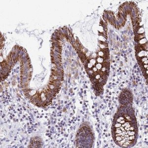 Anti-SAMD13 antibody produced in rabbit 