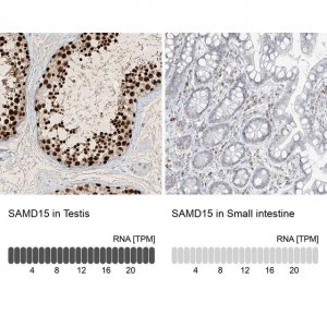 Anti-SAMD15 antibody produced in rabbit 