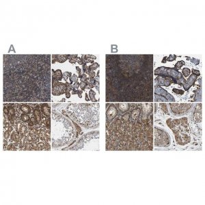 Anti-SAMD9L antibody produced in rabbit 