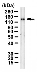 Anti-SARS-CoV-1/2 S protein CR3022 Antibody ZooMAb Human Monoclonal 