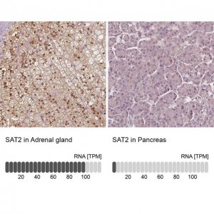 Anti-SAT2 antibody produced in rabbit 