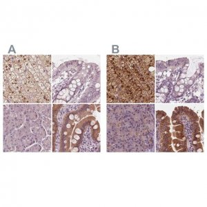 Anti-SAT2 antibody produced in rabbit 