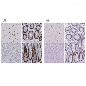 Anti-SATB2 antibody produced in rabbit 