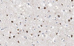 Anti-SATB2 Antibody, clone 1H17 ZooMAb Rabbit Monoclonal 