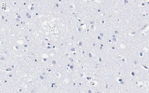 Anti-SATB2 Antibody, clone 1H17 ZooMAb Rabbit Monoclonal 