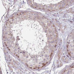 Anti-SAV1 antibody produced in rabbit 