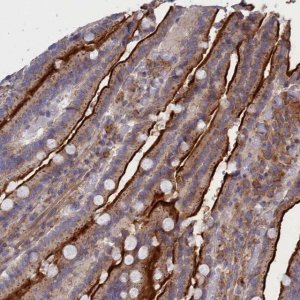 Anti-SCAMP4 antibody produced in rabbit HPA043284-100UL