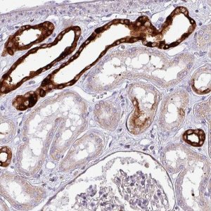 Anti-SCIN antibody produced in rabbit 