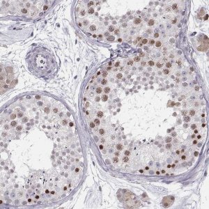 Anti-SCML2 antibody produced in rabbit 