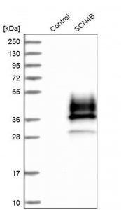 Anti-SCN4B antibody produced in rabbit HPA017293-100UL
