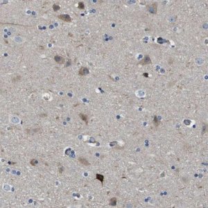Anti-SCN4B antibody produced in rabbit HPA017293-100UL