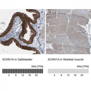 Anti-SCNN1A antibody produced in rabbit 