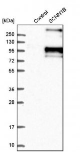Anti-SCNN1B antibody produced in rabbit 