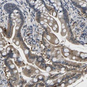 Anti-SCNN1B antibody produced in rabbit 