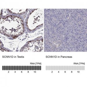 Anti-SCNN1D antibody produced in rabbit 