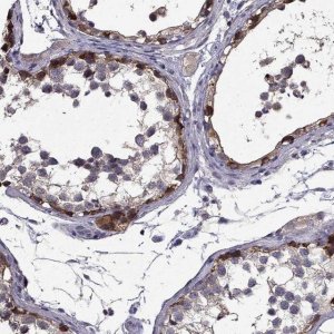 Anti-SCNN1D antibody produced in rabbit 